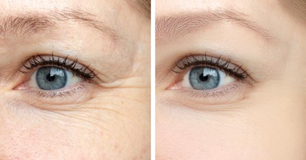 This Eye Cream Works on the Spot and Reduces Fine Lines by 50% in 12 Weeks